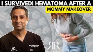 I Got a Mommy Makeover amp This Is What Happened HEMATOMA Complication [upl. by Belier]