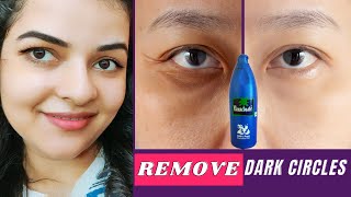 How to Remove Dark Circles Naturally in 3 Days with Coconut Oil 100 Results  Remove Dark Circles [upl. by Gargan]