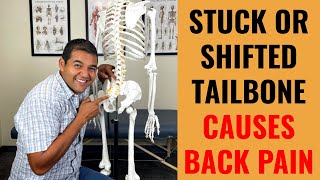 Can A Stuck Or Shifted Tailbone Cause Lower Back Pain How To Fix It [upl. by Seira]