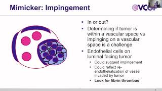 Standardising Tumour Pathology Reporting Lymphovascular Invasion [upl. by Avra812]