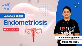 Endometriosis  Causes Symptoms amp Treatment [upl. by Meta]