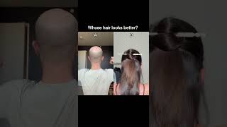 WHOSE HAIR LOOKS BETTER 👍🏻 hair hairstyle haircare youtubeshorts shorts bald [upl. by Lazor]