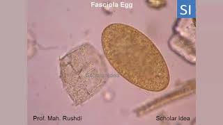 Fasciola egg [upl. by Stark]