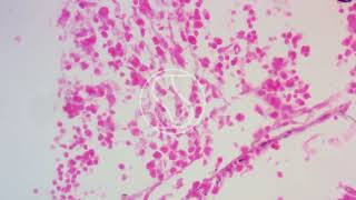 Coccidioides immitis under the microscope with GMSHaematoxylin and Eosin stain [upl. by Aruasor]