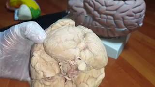 Anatomy of Cerebellum  Lab Demo  Dr Yusuf [upl. by Hotze]