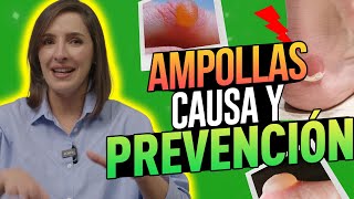 🔴 Se DEBEN REVENTAR las AMPOLLAS DERMATOLOGA EXPLICA drapilarochoa  Dermatologa [upl. by Gail]