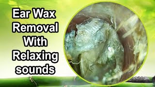 Ear wax removal with relaxing sounds [upl. by Gar]