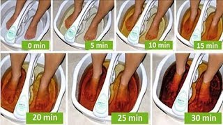 Here’s How To Detoxify Your Whole Body Through The Feet [upl. by Aitnic]