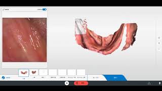 Scan fully edentulous with Primescan [upl. by Christianity]