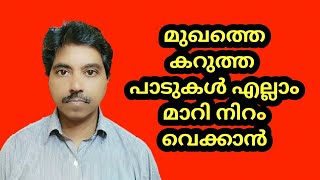 മുഖം വെളുക്കാൻ  Skin Whitening Home Remedies [upl. by Ahsenar]