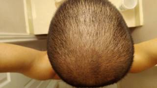 Hair Growth Time Lapse [upl. by Agem]