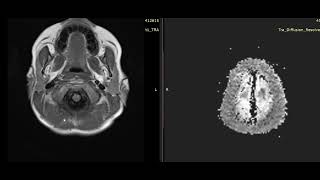 case 11a  7 year old male patient [upl. by Ghiselin]