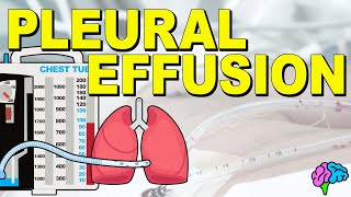 What is a Pleural Effusion EXPLAINED [upl. by Fayette]