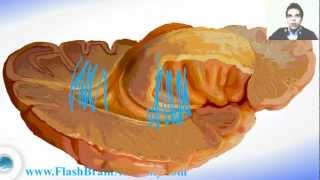 Lateral Ventricle and Insule  Brain Anatomy [upl. by Madalyn]