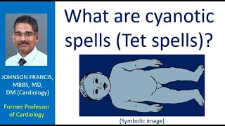 What are cyanotic spells Tet spells [upl. by Amalle]