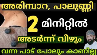 അരിമ്പാറ പാലുണ്ണി 2 മിനിറ്റിൽ അടർന്നു വീഴുംWarts Removal Malayalam Natural Remedy [upl. by Ayamat]