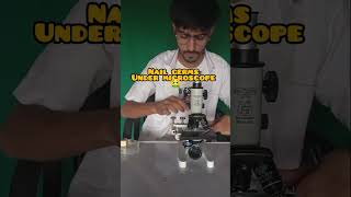 nail germs under microscope 🤮viralvedio microscope trendingshorts [upl. by Leilah839]