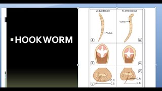 Parasitology 200 a Hookwormancylostoma duodenalenecator americanus [upl. by Bear729]