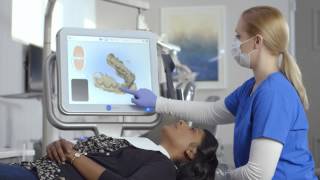 Master the iTero Element™ intraoral scanner essential tips for perfect impressions [upl. by Arola154]