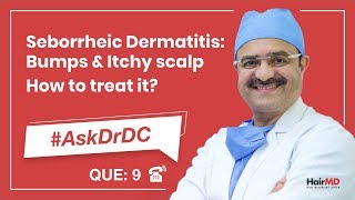 How To Treat Seborrheic Dermatitis कैसे seborrheic का इलाज करे  AskDrDc Ep 9  In HINDI [upl. by Agustin]