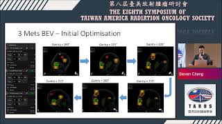 601Steven Cheng User Experience in BrainLab Multiple Brain Mets in Conjunction with ExacTrac Dynamic [upl. by Allebram17]