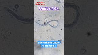 Microfilaria under microscope 🪱🪱 medical laboratory [upl. by Taimi]