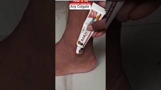 ✅ pedicure at homeGet fair feet and hands just 2 minutesFeet whitening tips skincare pedicure [upl. by Aluino789]