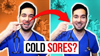 How to get rid of cold sores on lips fast and treatment [upl. by Annawad996]