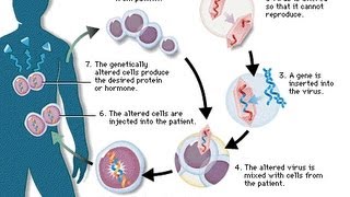 Human gene therapy types of gene therapy part 4 [upl. by Calisa]