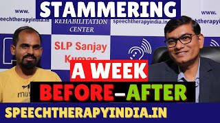 SLP Sanjay Kumar  PrePost  हकलाहट Stammering Speech Therapy Within A Week  AIIMS Delhi Alumnus [upl. by Macnamara313]