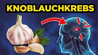 Schockierende Entdeckung über Knoblauch und Krebs – Iss niemals Knoblauch mit diesem 🧄 [upl. by Dorine]