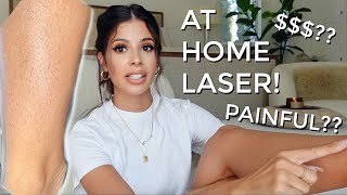 I TRIED LASER HAIR REMOVAL AT HOME this is what happened [upl. by Pearce602]