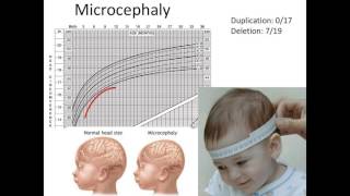 1q211 Neurological Findings and Brain Imaging Studies [upl. by Sergent]