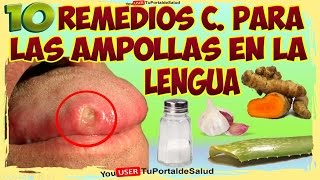 10 Remedios Caseros para las Ampollas en la Lengua [upl. by Greenleaf731]