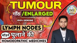 Enlarged lymph nodesCausesTreatment गिल्टि धुलाने वाली दवा  Tumour homoeopathic medicine [upl. by Valenba]