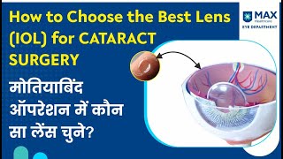 Which Lens IOL to choose for Cataract Surgery  Price Choices amp Benefits of IOL Lenses [upl. by Amatruda]