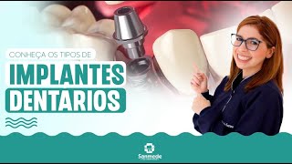 IMPLANTES DENTÁRIOS  CONHEÇA OS TIPOS [upl. by Attenal]