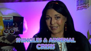 Shingles amp Adrenal Insufficiency hearing loss shingles in the ear amp eye Sheehans syndrome [upl. by Earissed227]