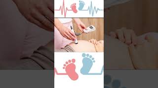 Fetal heart beat part 2  pregnancy trending [upl. by Ahter796]