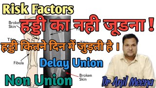 Non Union Bone Causes and Treatment  Delayed Union Fracture  delayed union malunion  In Hindi [upl. by Erodaeht]