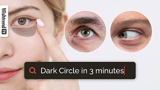 How To Get Rid Of Dark Circles👁️  Treatment  SelfCare Tips👍 [upl. by Repooc91]