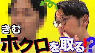 【美容動画】きむホクロを取る！？【インディアンス】【ホクロ除去】 [upl. by Hedaza]