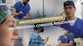 RINOPLASTIA ULTRASONICA  Preoperatorio consejos resultados [upl. by Aitsirk]