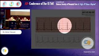 Pediatric ECG part 2 by Dr Amer Hassan [upl. by Ensoll160]