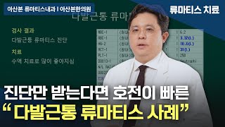 류마티스내과 다발근통 류마티스는 진단받는 것이 가장 중요합니다 l 서울류마티스내과 [upl. by Baalman896]