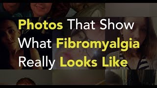 Photos That Show What Fibromyalgia Really Looks Like [upl. by Tynan]