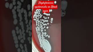 Staphylococcus epidermidis Colony Morphology on Blood Agar [upl. by Lativa]