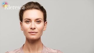 Kleresca® Skin Rejuvenation [upl. by Latt]