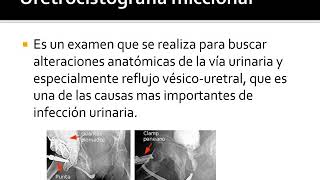 Uretrocistografía retrograda y miccional [upl. by Nepsa]