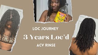 ACV Rinse on Locs  Loc Update  Locs w Alopecia [upl. by Rysler]